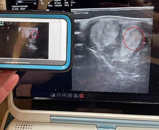 Success Story - Red Light Therapy Pad